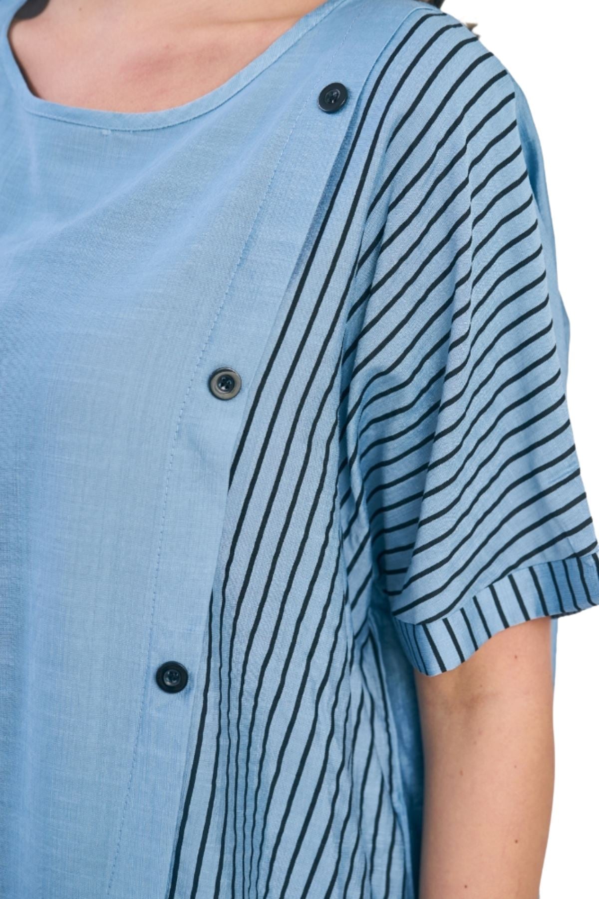 Stripe Print Side Button Detail Cotton Top