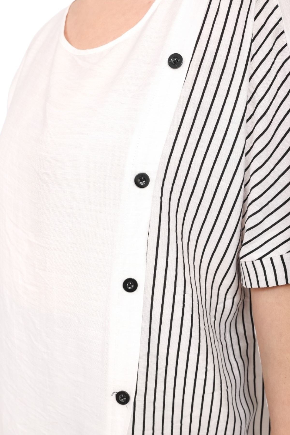 Stripe Print Side Button Detail Cotton Top