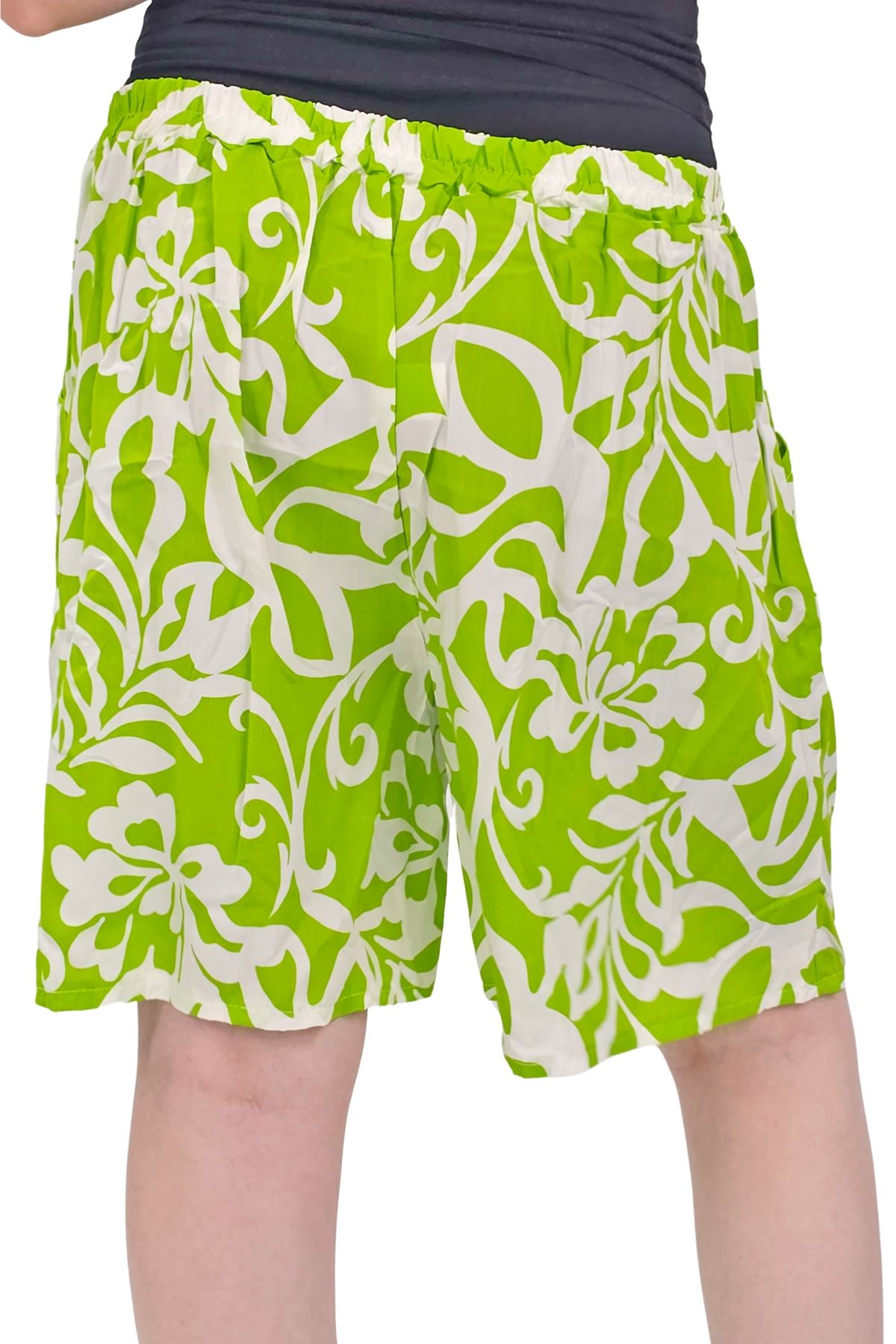Bold Tropical Print High-Waisted Shorts