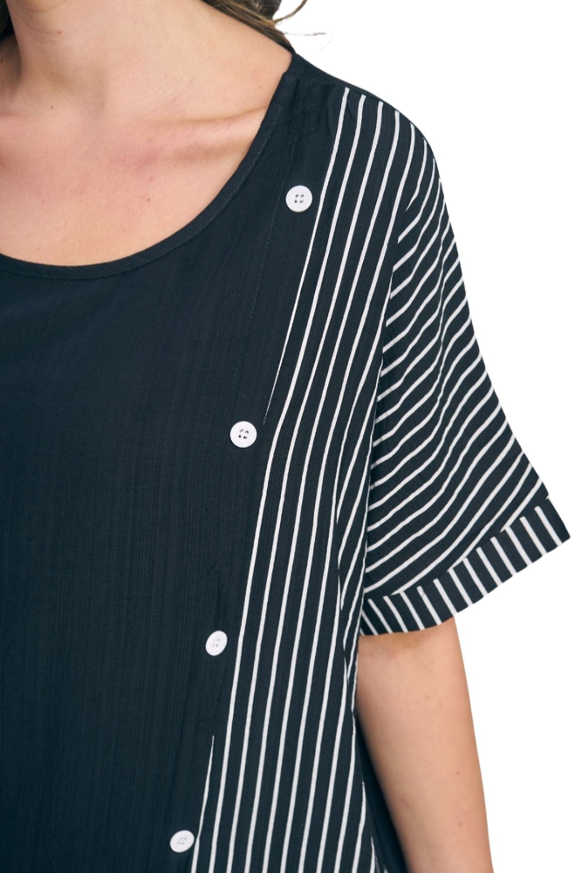 Stripe Print Side Button Detail Cotton Top
